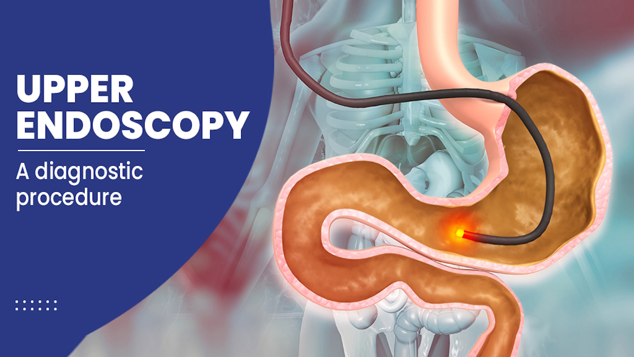 Upper Endoscopy Centre